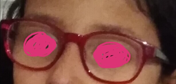 Lunette perdu