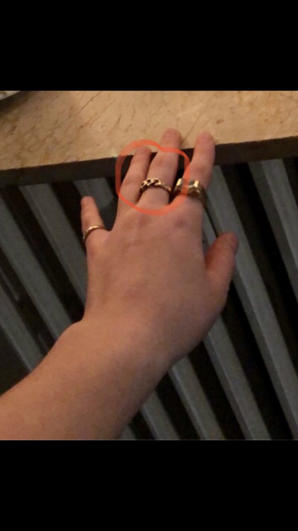 Perte bague motif chaîne