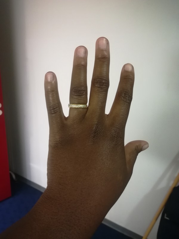 Perte d'une bague