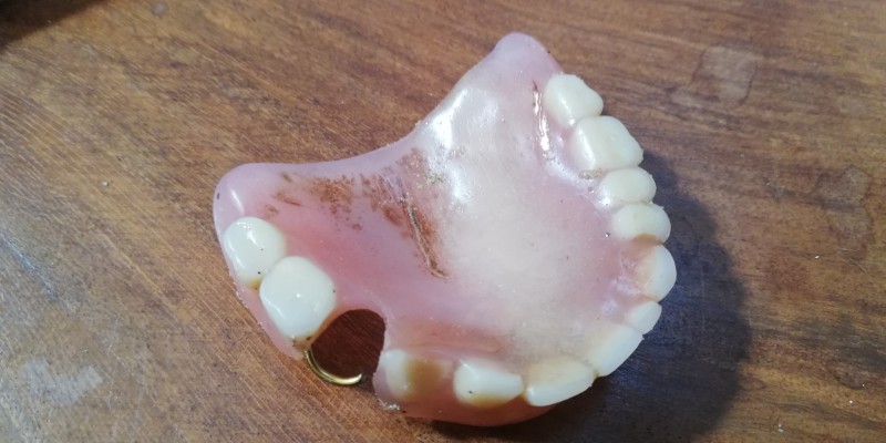 Trouvé dentier sur la plage entre Rochebonne et la Hoguette