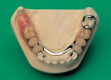 Dentier