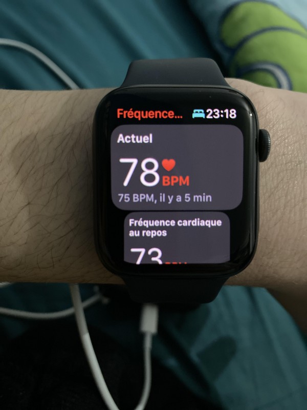 Perdu Apple Watch a la médiathèque (MeMo) de montauban au niveau du croisement aldi bibliothèque